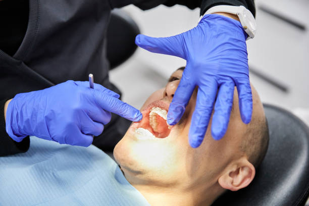 Best Emergency Treatment for Toothache in Ogallala, NE